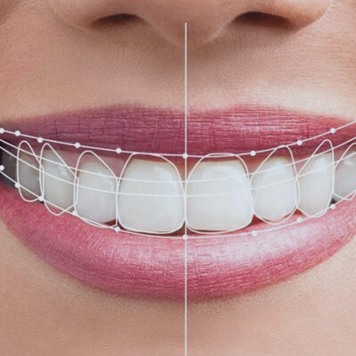 diseño-digital-sonrisa (1)